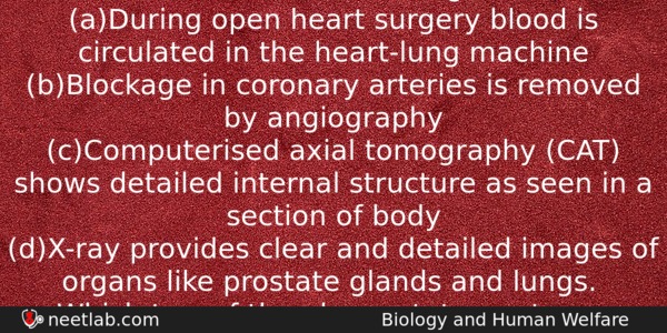 Consider The Following Statements About Biomedical Technologies Aduring Open Heart Biology Question 